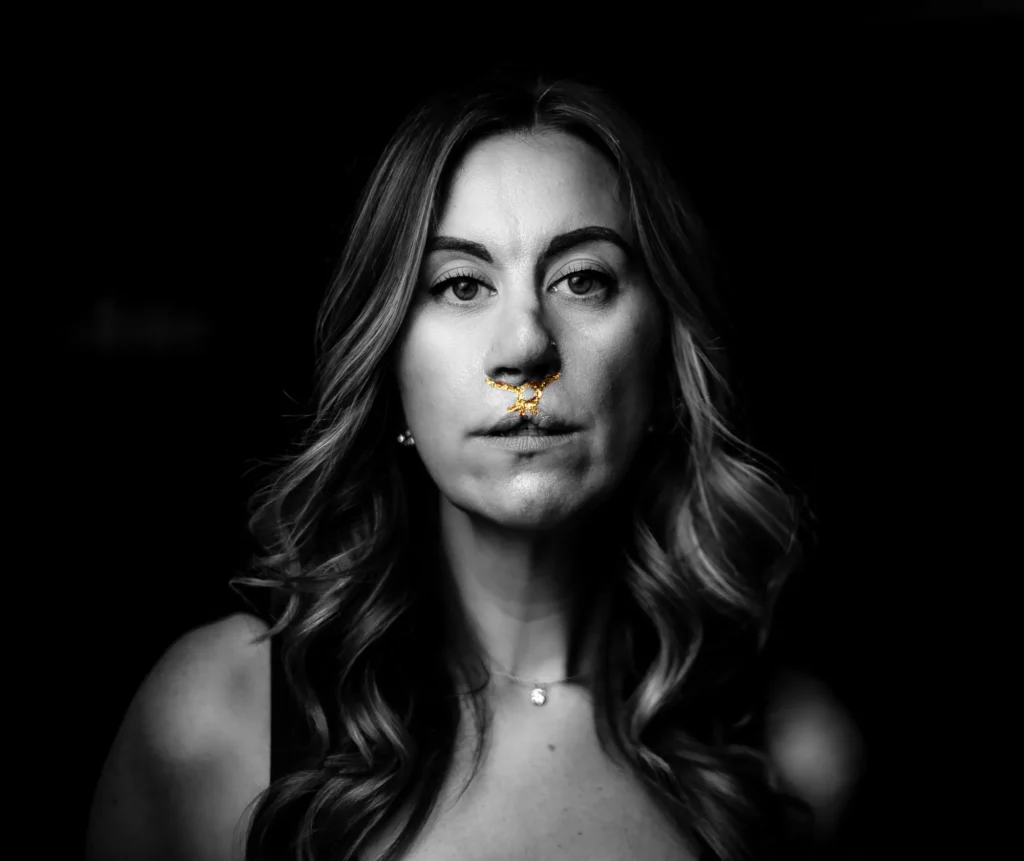 Ashley Barbour faces the camera, a line of gold over her scar
